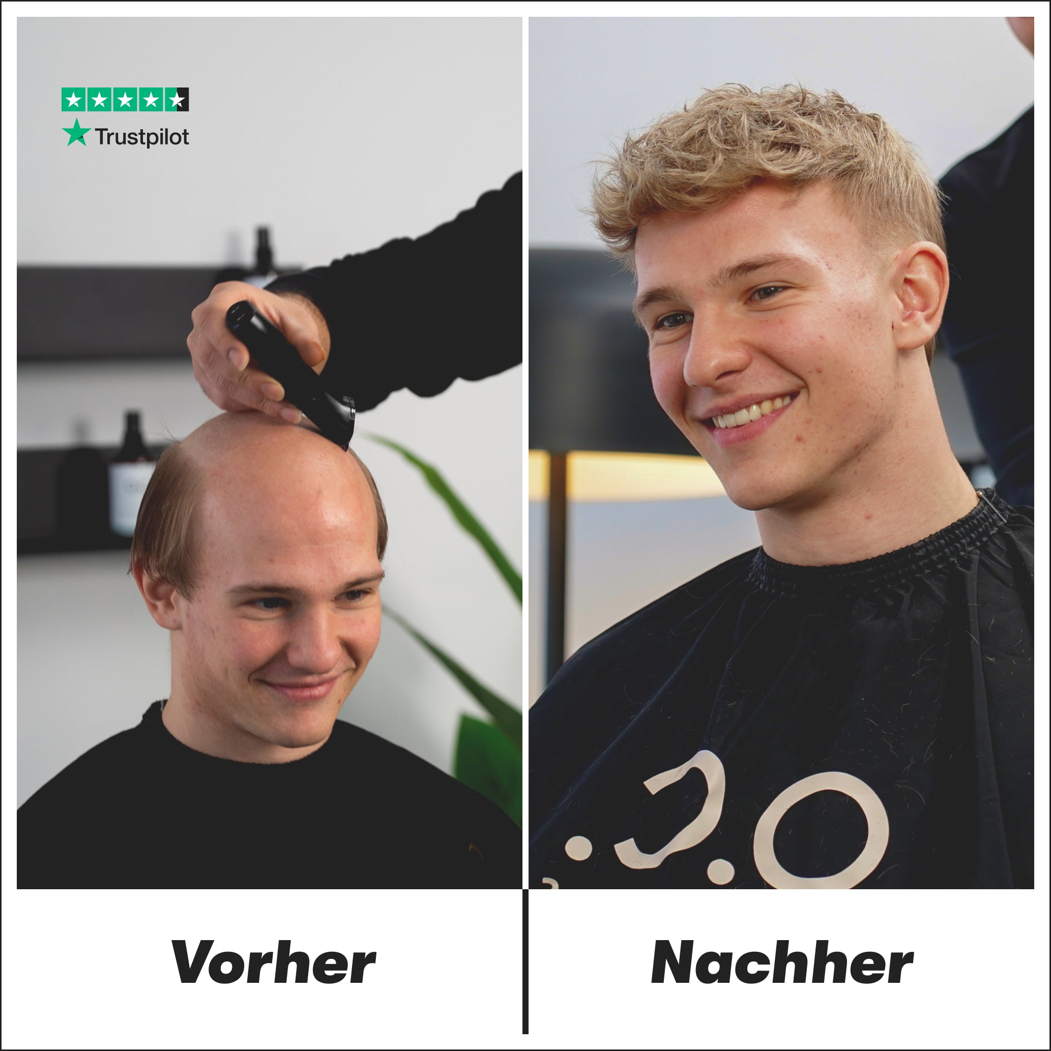 O.C. NOW® Haarsystem für Männer