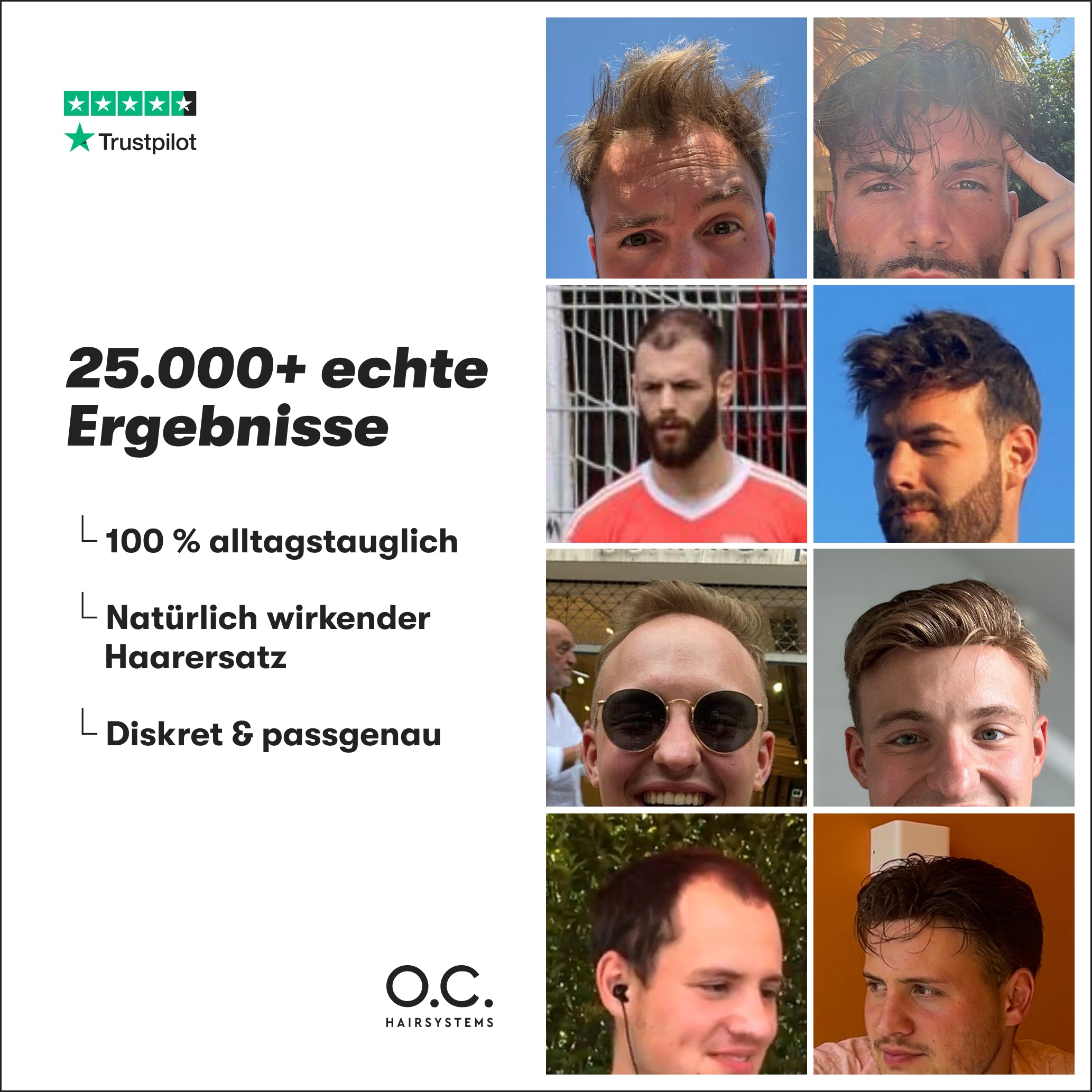O.C. NOW® Haarsystem für Männer
