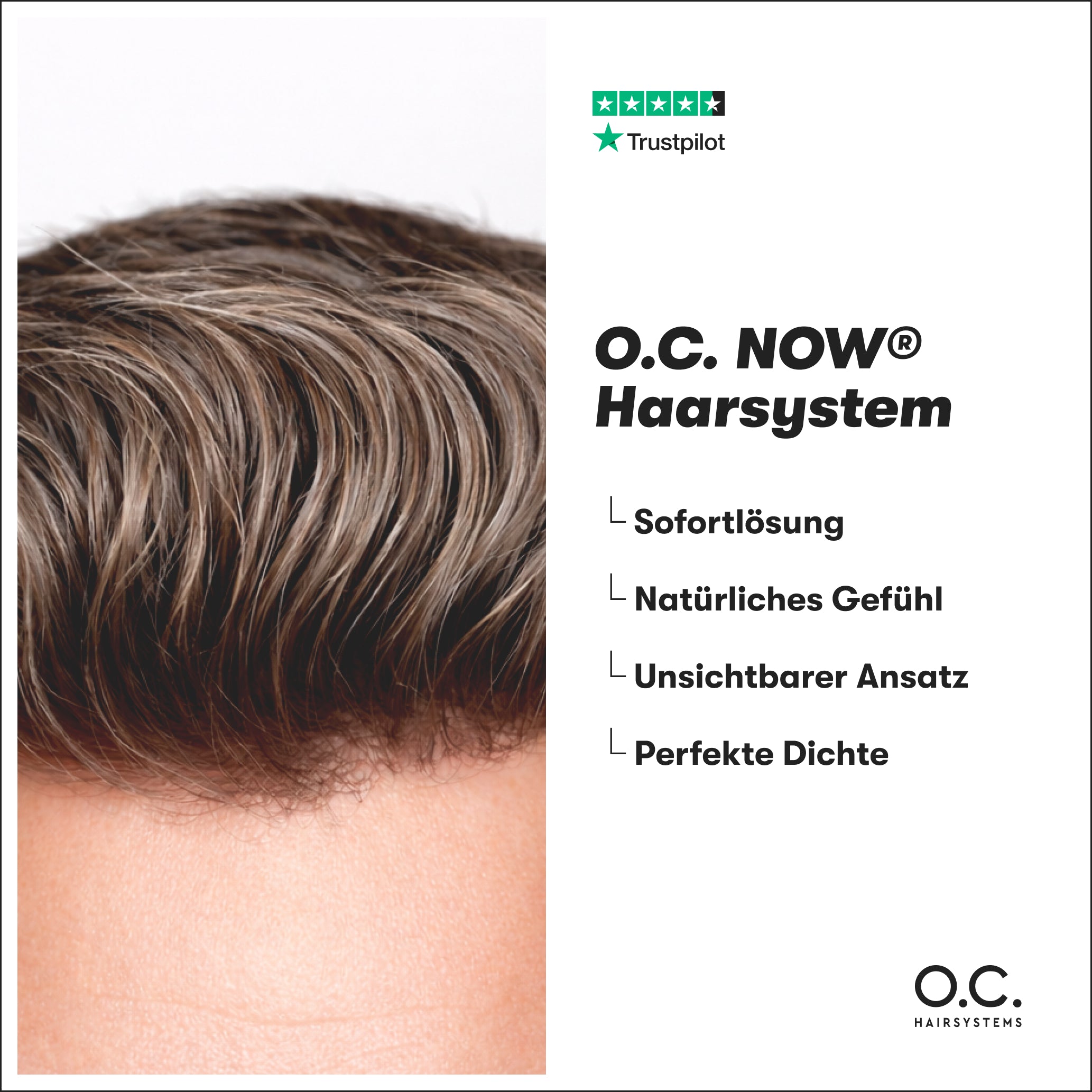 O.C. NOW® Haarsystem für Männer